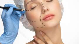 Harmonização Facial Em Recife